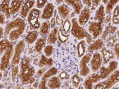 Immunohistochemistry-Paraffin: Nephronophthisis Antibody [NBP2-98647]