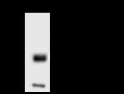 Immunoprecipitation: Nephronophthisis Antibody [NBP2-98647]
