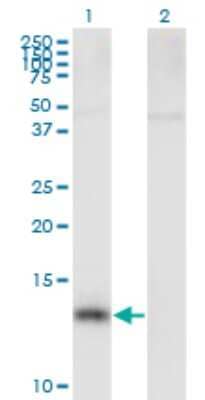 Western Blot: Nephronophthisis Antibody [H00004867-B01P]