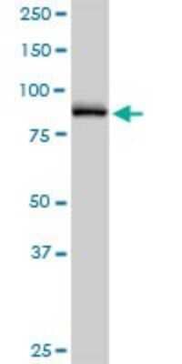 Western Blot: Nephronophthisis Antibody [H00004867-D01P]