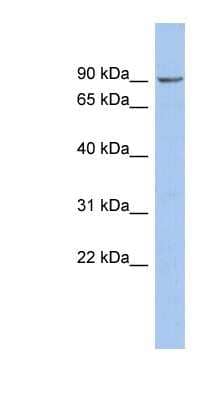 Western Blot: Nephronophthisis Antibody [NBP1-59110]