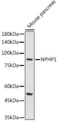 Western Blot: Nephronophthisis AntibodyAzide and BSA Free [NBP2-94059]