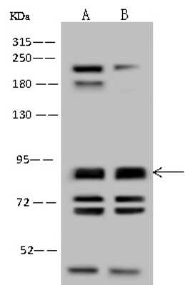 Western Blot: Nephronophthisis Antibody [NBP2-98647]