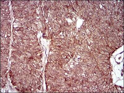 Immunohistochemistry: Neprilysin-2/MMEL1 Antibody (2D2H5) - BSA Free [NBP2-52511]