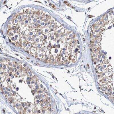 Immunohistochemistry: Neprilysin-2/MMEL1 Antibody [NBP1-92125]