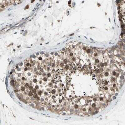 Immunohistochemistry-Paraffin: Neprilysin-2/MMEL1 Antibody [NBP1-92126]