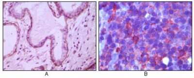 Immunohistochemistry-Paraffin: Neprilysin/CD10 Antibody (2A1H5E1) - BSA Free [NBP1-47356]