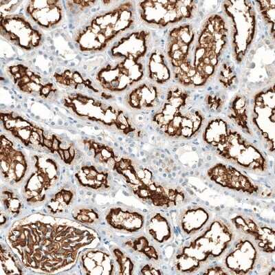 Immunohistochemistry-Paraffin: Neprilysin/CD10 Antibody (CL12448) [NBP3-15135]