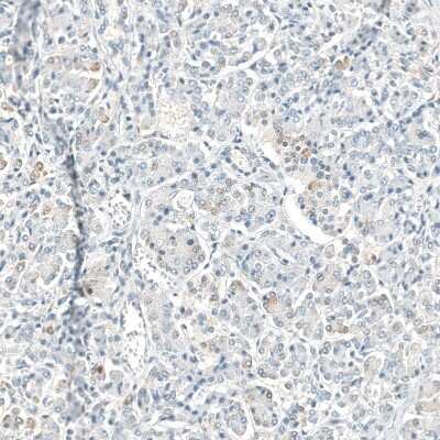 Immunohistochemistry-Paraffin: Neprilysin/CD10 Antibody (CL12448) [NBP3-15135]