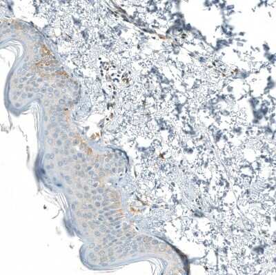 Immunohistochemistry-Paraffin: Neprilysin/CD10 Antibody (CL12448) [NBP3-15135]