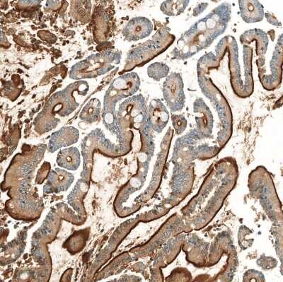 Immunohistochemistry-Paraffin: Neprilysin/CD10 Antibody (CL12448) [NBP3-15135]