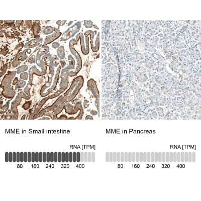 Immunohistochemistry-Paraffin: Neprilysin/CD10 Antibody (CL12448) [NBP3-15135]