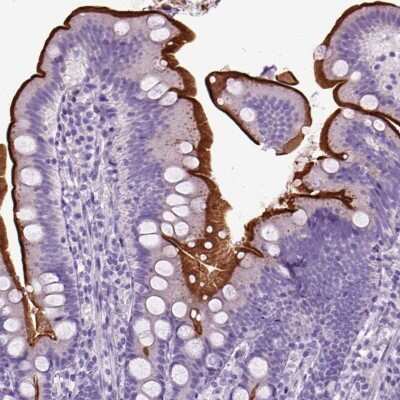 Immunohistochemistry: Neprilysin/CD10 Antibody [NBP2-49050]