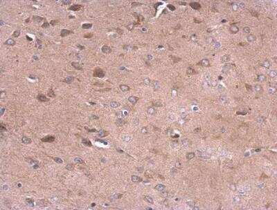 Immunohistochemistry-Paraffin: Neprilysin/CD10 Antibody [NBP2-15771]