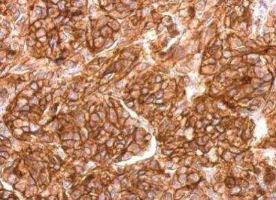 Immunohistochemistry-Paraffin: Neprilysin/CD10 Antibody [NBP2-15771]