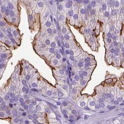 Immunohistochemistry-Paraffin: Neprilysin/CD10 Antibody [NBP2-48701]