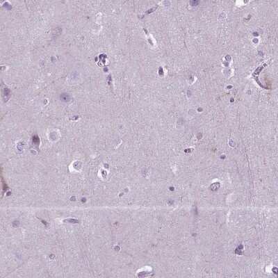 Immunohistochemistry-Paraffin: Neprilysin/CD10 Antibody [NBP2-49050]