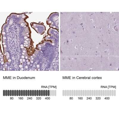 Immunohistochemistry-Paraffin: Neprilysin/CD10 Antibody [NBP2-49050]