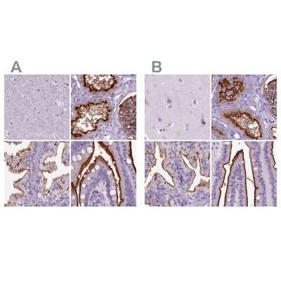 Immunohistochemistry-Paraffin: Neprilysin/CD10 Antibody [NBP2-49050]