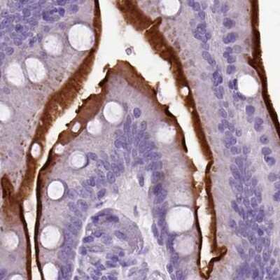 Immunohistochemistry-Paraffin: Neprilysin/CD10 Antibody [NBP2-49050]
