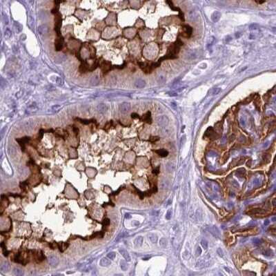 Immunohistochemistry-Paraffin: Neprilysin/CD10 Antibody [NBP2-49050]