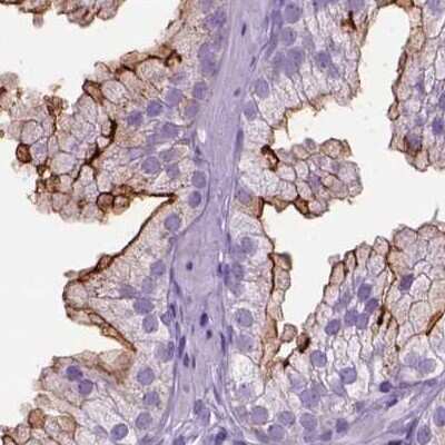 Immunohistochemistry-Paraffin: Neprilysin/CD10 Antibody [NBP2-49050]