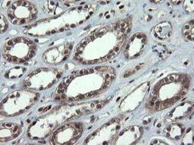 Immunohistochemistry-Paraffin: Neprilysin/CD10 Antibody (OTI3D11) - Azide and BSA Free [NBP2-72941]