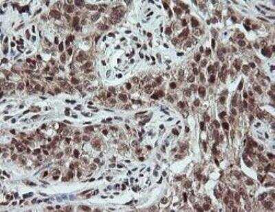 Immunohistochemistry-Paraffin: Neprilysin/CD10 Antibody (OTI3D11) - Azide and BSA Free [NBP2-72941]