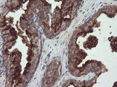 Immunohistochemistry-Paraffin: Neprilysin/CD10 Antibody (OTI3D11) - Azide and BSA Free [NBP2-72941]