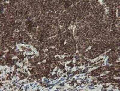 Immunohistochemistry-Paraffin: Neprilysin/CD10 Antibody (OTI3D11) - Azide and BSA Free [NBP2-72941]