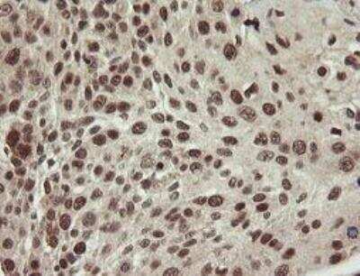 Immunohistochemistry-Paraffin: Neprilysin/CD10 Antibody (OTI3D11) - Azide and BSA Free [NBP2-72941]