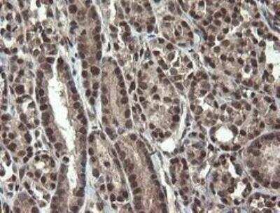 Immunohistochemistry-Paraffin: Neprilysin/CD10 Antibody (OTI3D11) - Azide and BSA Free [NBP2-72941]