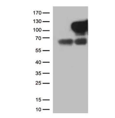 Western Blot: Neprilysin/CD10 Antibody (OTI3D11)Azide and BSA Free [NBP2-72941]