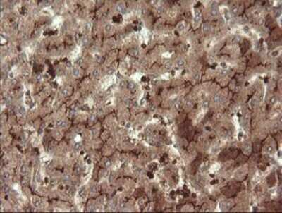 Immunohistochemistry: Neprilysin/CD10 Antibody (OTI3D11) [NBP2-45817]