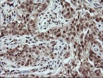 Immunohistochemistry: Neprilysin/CD10 Antibody (OTI3D11) [NBP2-45817]