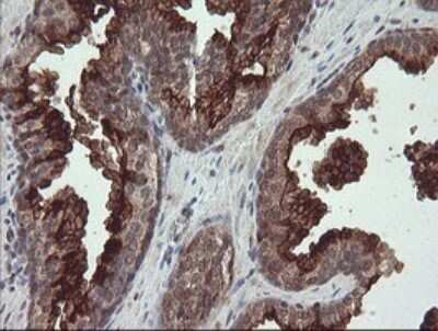 Immunohistochemistry: Neprilysin/CD10 Antibody (OTI3D11) [NBP2-45817]