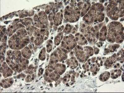 Immunohistochemistry: Neprilysin/CD10 Antibody (OTI3D11) [NBP2-45817]