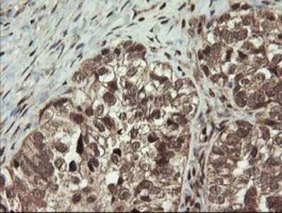Immunohistochemistry: Neprilysin/CD10 Antibody (OTI3D11) [NBP2-45817]