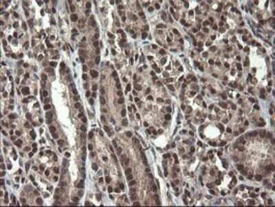 Immunohistochemistry: Neprilysin/CD10 Antibody (OTI3D11) [NBP2-45817]