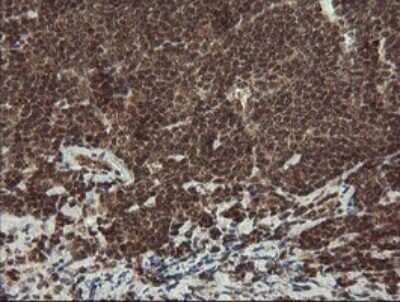 Immunohistochemistry: Neprilysin/CD10 Antibody (OTI3D11) [NBP2-45817]