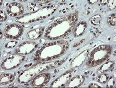 Immunohistochemistry: Neprilysin/CD10 Antibody (OTI3D11) [NBP2-45817]