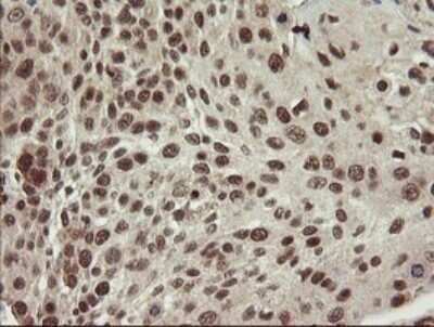 Immunohistochemistry: Neprilysin/CD10 Antibody (OTI3D11) [NBP2-45817]