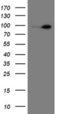 Western Blot: Neprilysin/CD10 Antibody (OTI3D11) [NBP2-45817]