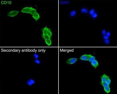Immunocytochemistry/ Immunofluorescence: Neprilysin/CD10 Antibody (SN75-07) [NBP2-67717]