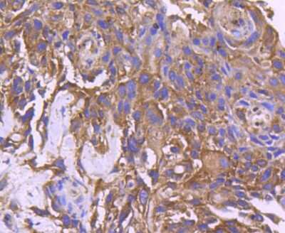 Immunohistochemistry-Paraffin: Neprilysin/CD10 Antibody (SN75-07) [NBP2-67717]