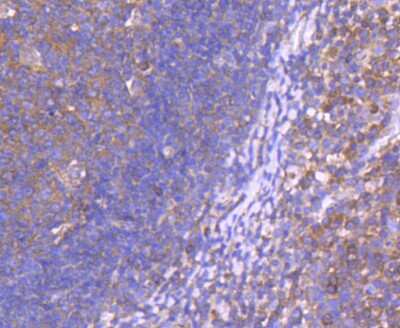 Immunohistochemistry-Paraffin: Neprilysin/CD10 Antibody (SN75-07) [NBP2-67717]