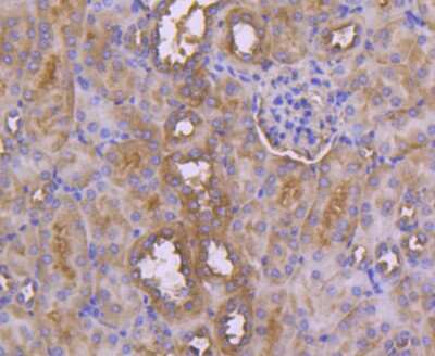 Immunohistochemistry-Paraffin: Neprilysin/CD10 Antibody (SN75-07) [NBP2-67717]