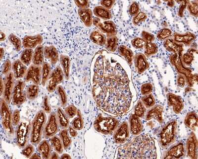 Immunohistochemistry-Paraffin: Neprilysin/CD10 Antibody (SN75-07) [NBP2-67717]