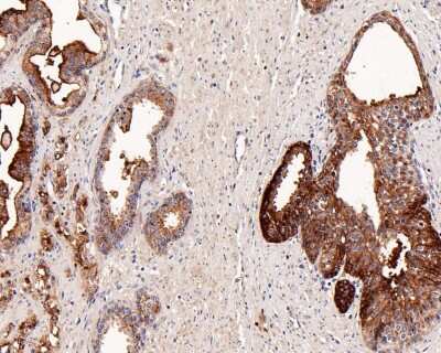 Immunohistochemistry-Paraffin: Neprilysin/CD10 Antibody (SN75-07) [NBP2-67717]