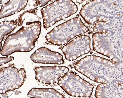 Immunohistochemistry-Paraffin: Neprilysin/CD10 Antibody (SN75-07) [NBP2-67717]